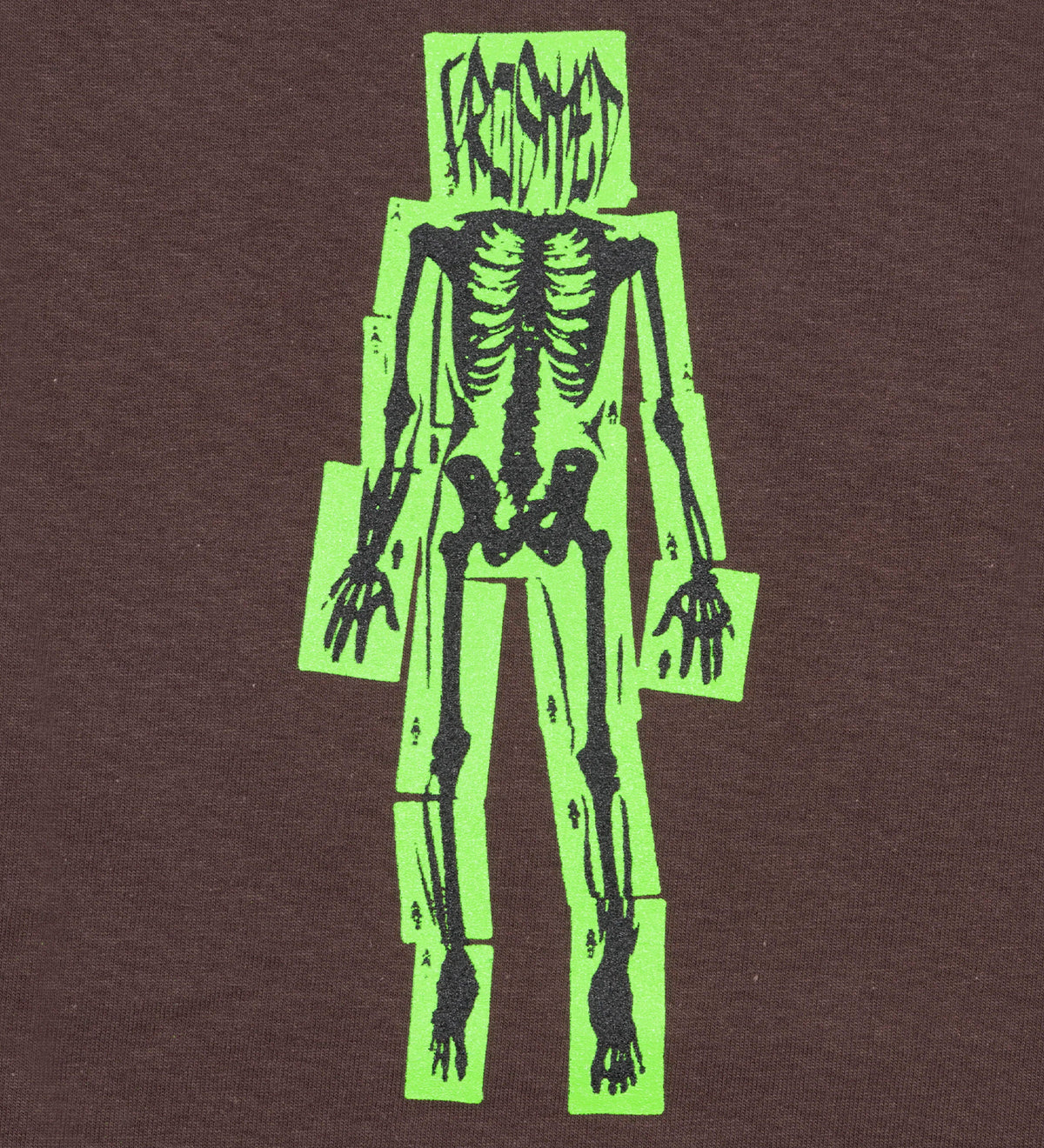 X-Ray, Brown