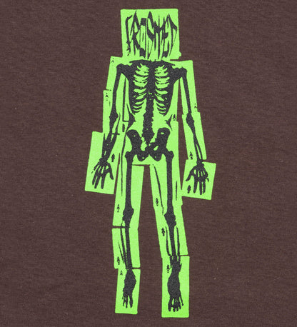 X-Ray, Brown
