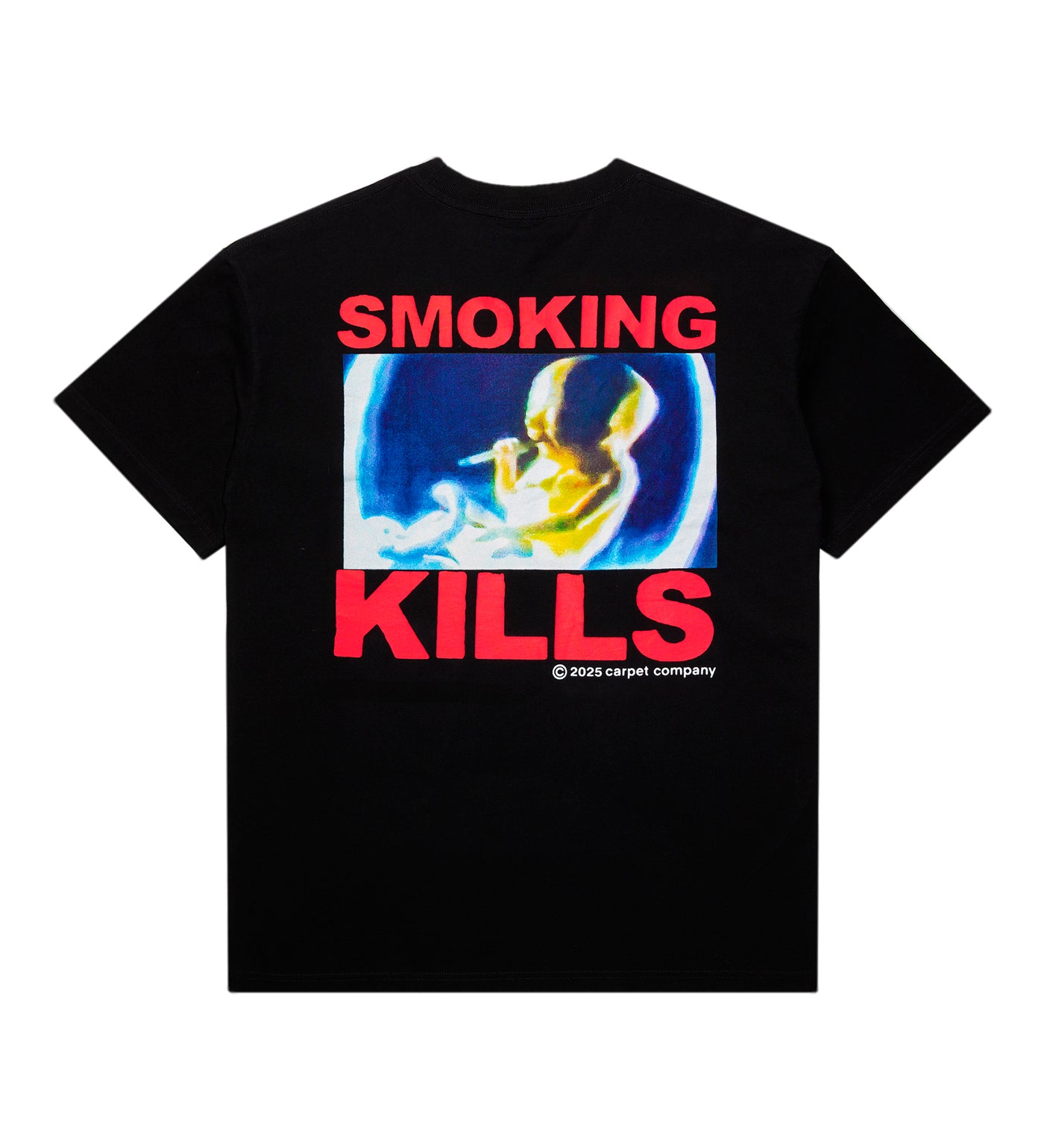 Smoking Kills, Black
